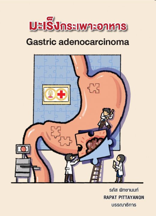 โรคมะเร็งกระเพาะอาหาร (GASTRIC ADENOCARCINOMA)