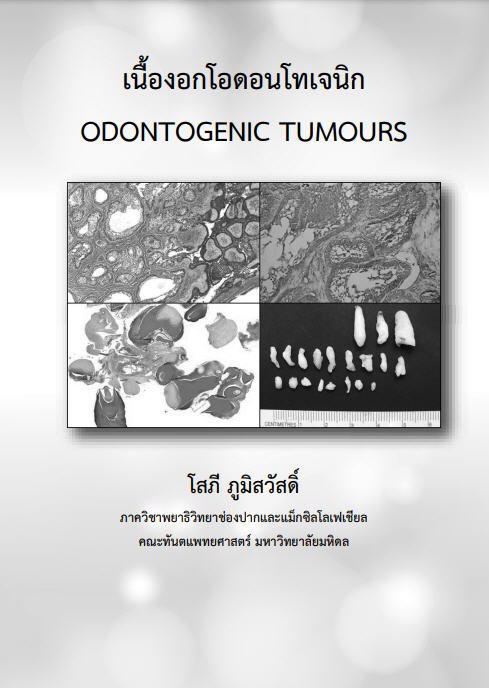 เนื้องอกโอดอนโทเจนิก (ODONTOGENIC TUMOURS)