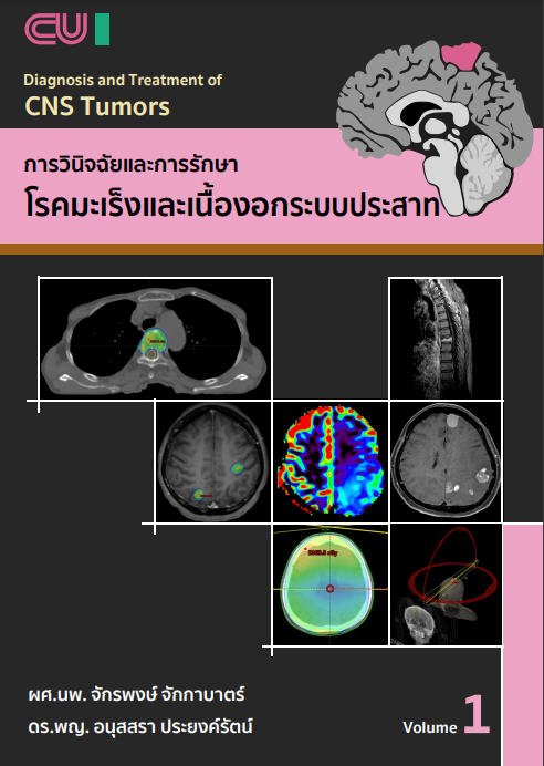 การวินิจฉัยและการรักษาโรคมะเร็งและเนื้องอกในระบบประสาท 1 (DIAGNOSIS AND TREATMENT OF CNS TUMORS)