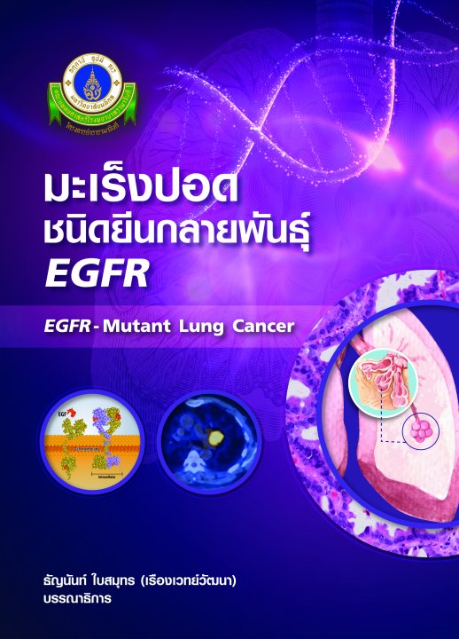 มะเร็งปอดชนิดยีนกลายพันธุ์ EGFR (EGFR Mutant Lung Cancer)