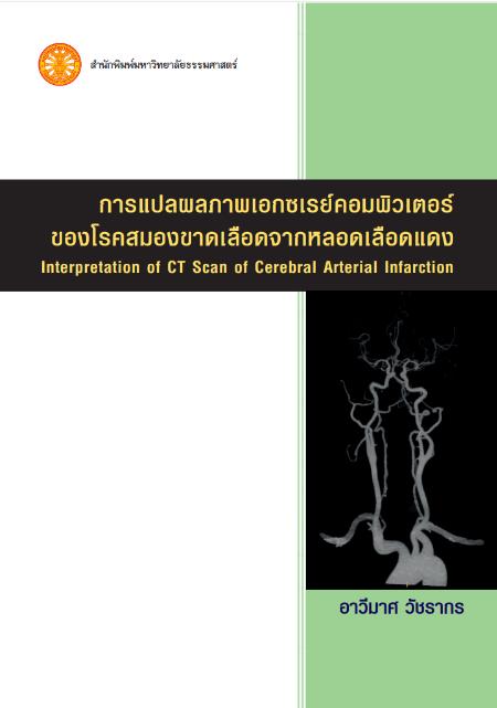 การแปลผลภาพเอกซเรย์คอมพิวเตอร์ของโรคสมองขาดเลือดจากหลอดเลือดแดง