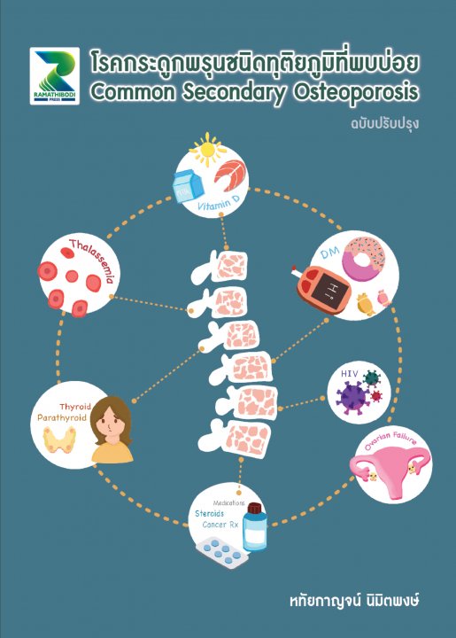 โรคกระดูกพรุนชนิดทุติยภูมิที่พบบ่อย (Common Secondary Osteoporosis) (ฉบับปรับปรุง)