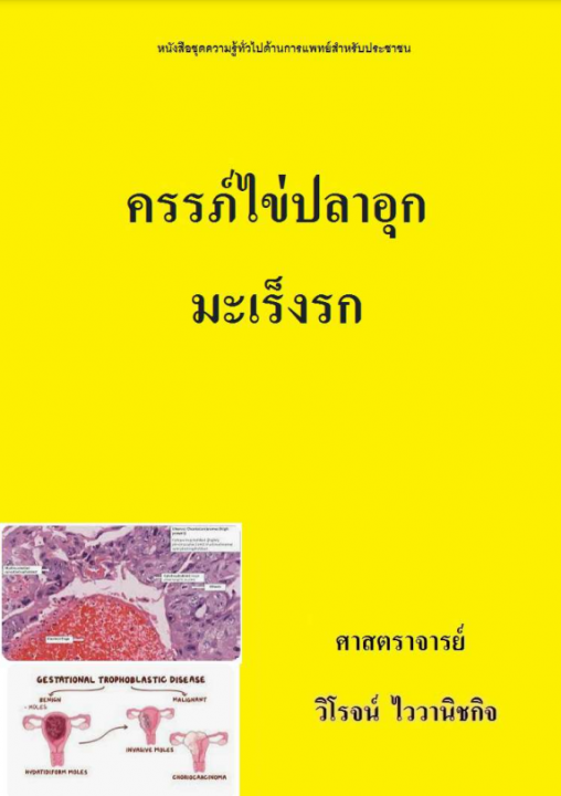 ครรภ์ไข่ปลาอุกมะเร็งรก
