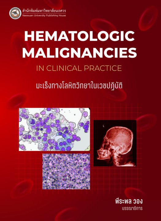 มะเร็งทางโลหิตวิทยาในเวชปฏิบัติ (HEMATOLOGIC MALIGNANCIES IN CLINICAL PRACTICE)