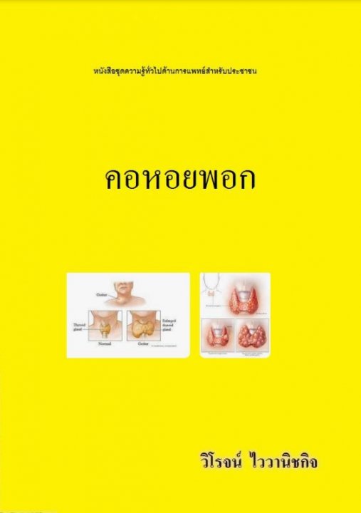 คอหอยพอก