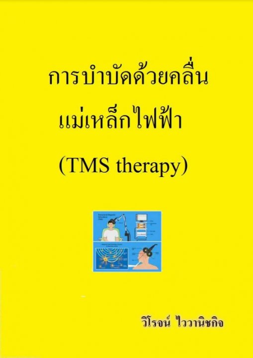การบำบัดด้วยคลื่นแม่เหล็กไฟฟ้า (TMS therapy)