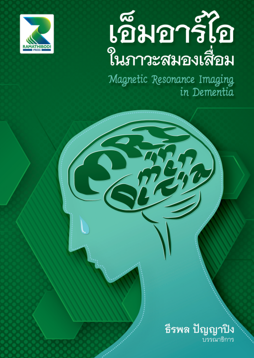 เอ็มอาร์ไอในภาวะสมองเสื่อม (MAGNETIC RESONANCE IMAGING IN DEMENTIA)