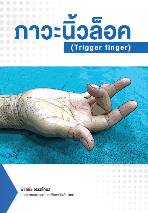 ภาวะนิ้วล็อค (Trigger finger)