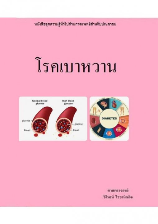 โรคเบาหวาน