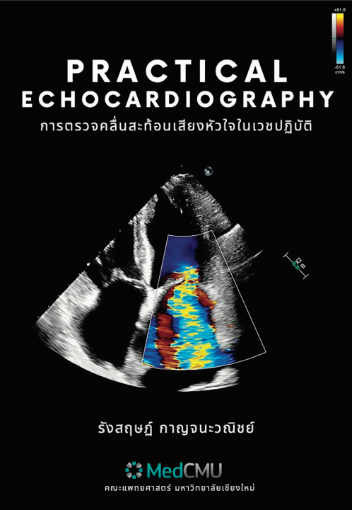 การตรวจคลื่นสะท้อนเสียงหัวใจในเวชปฎิบัติ (PRACTICAL ECHOCARDIOGRAPHY)