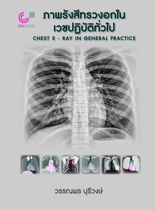 ภาพรังสีทรวงอกในเวชปฏิบัติทั่วไป (CHEST X-RAY IN GENERAL PRACTICE)