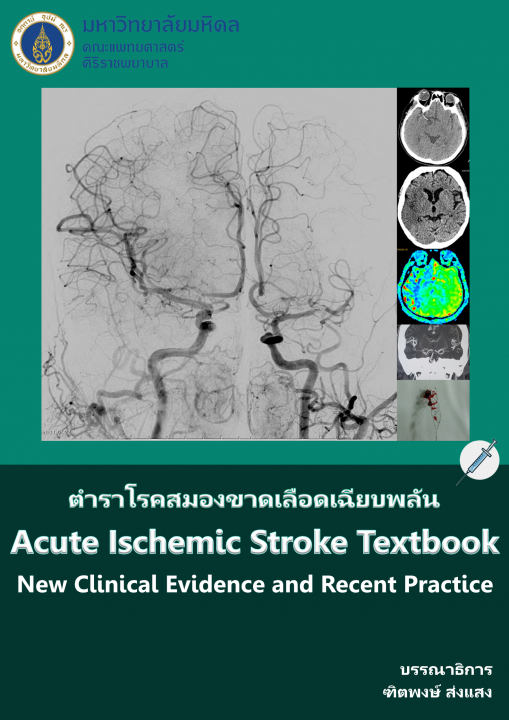 โรคสมองขาดเลือดเฉียบพลัน (ACUTE ISCHEMIC STROKE TEXTBOOK)