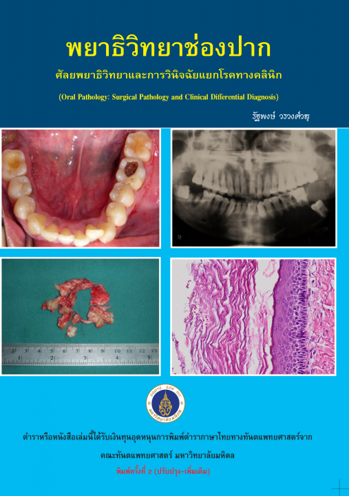 พยาธิวิทยาช่องปาก :ศัลยพยาธิวิทยาและการวินิจฉัยแยกโรคทางคลินิก