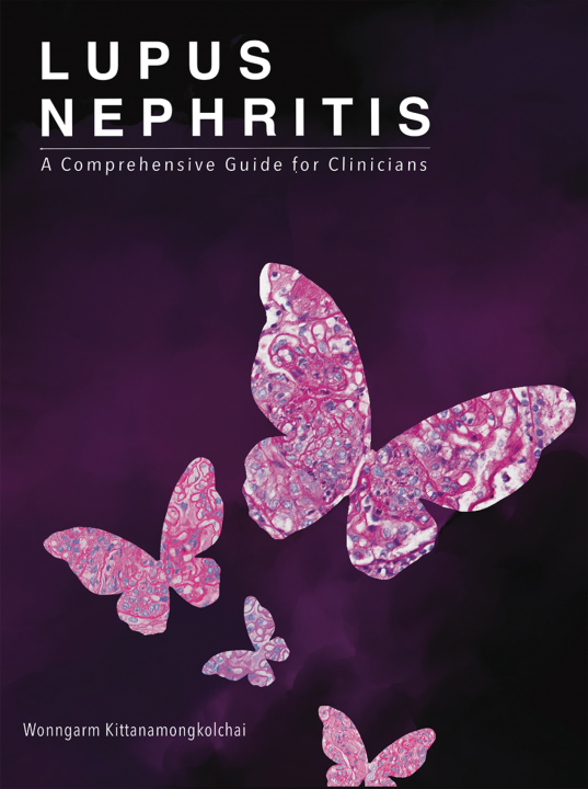 LUPUS NEPHRITIS: A COMPREHENSIVE GUIDE FOR CLINICIANS V.2