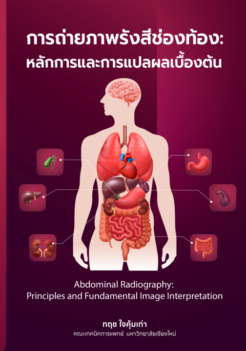 การถ่ายภาพรังสีช่องท้อง :หลักการและการแปลผลเบื้องต้น