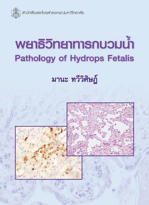 พยาธิวิทยาทารกบวมน้ำ (PATHOLOGY OF HYDROPS FETALIS)