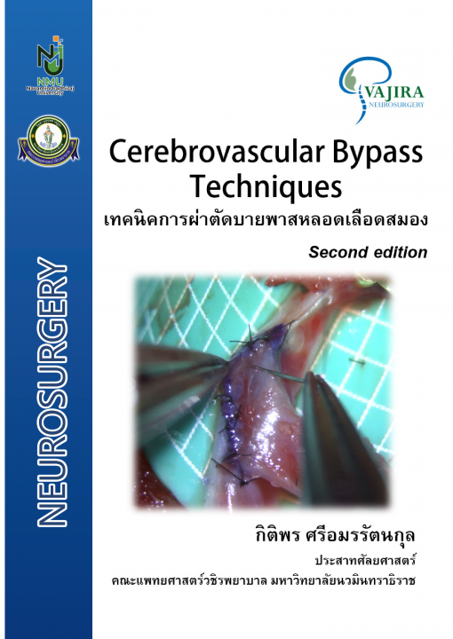 เทคนิคการผ่าตัดบายพาสหลอดเลือดสมอง (Cerebrovascular Bypass Techniques)