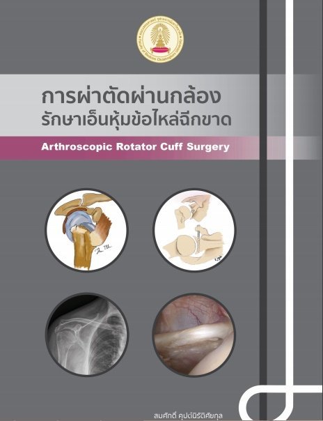 การผ่าตัดผ่านกล้องรักษาเอ็นหุ้มข้อไหล่ฉีกขาด (ARTHROSCOPIC ROTATOR CUFF SURGERY)