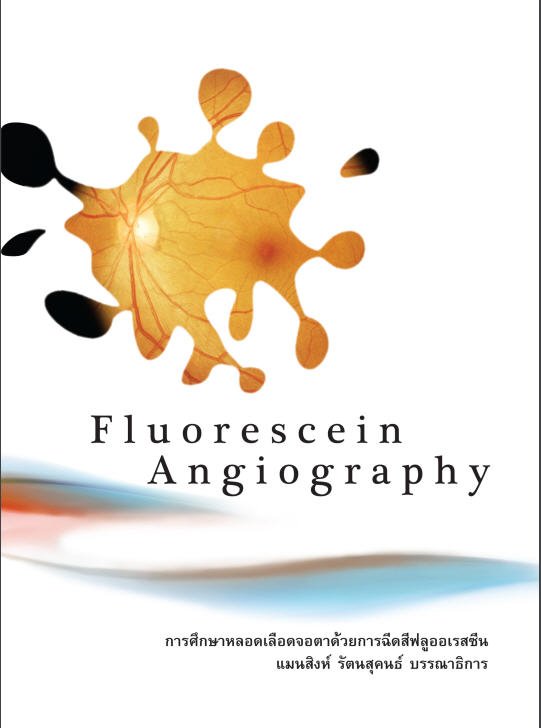 FLUORESCEIN ANGIOGRAPHY :การศึกษาหลอดเลือดจอตาด้วยการฉีดสีฟลูออเรสซีน