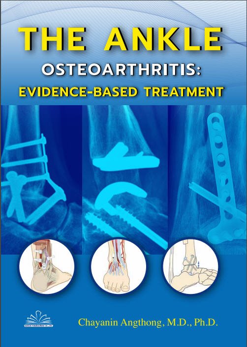 THE ANKLE OSTEOARTHRITIS EVIDENCE-BASED TREATMENT