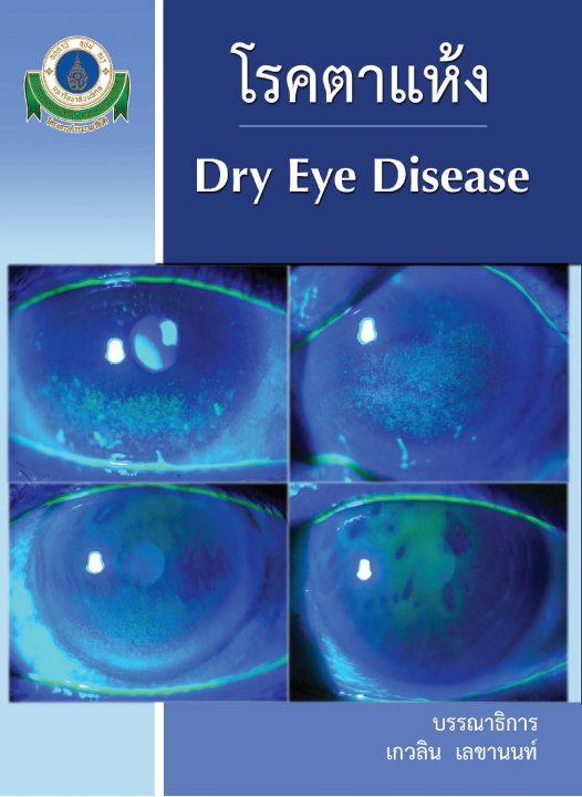 โรคตาแห้ง Dry Eye Disease